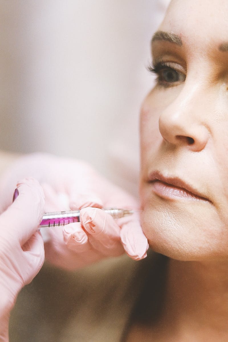 Close-up of a woman receiving a dermal filler injection, highlighting modern beauty treatments.